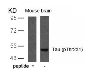 Western blot - Tau (Phospho-Thr231) Antibody from Signalway Antibody (11110) - Antibodies.com