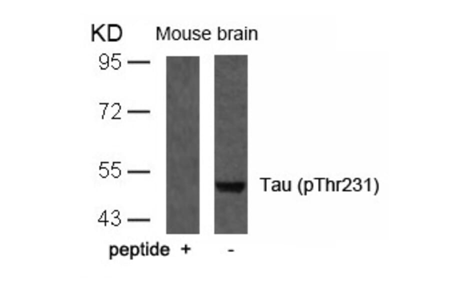Western blot - Tau (Phospho-Thr231) Antibody from Signalway Antibody (11110) - Antibodies.com