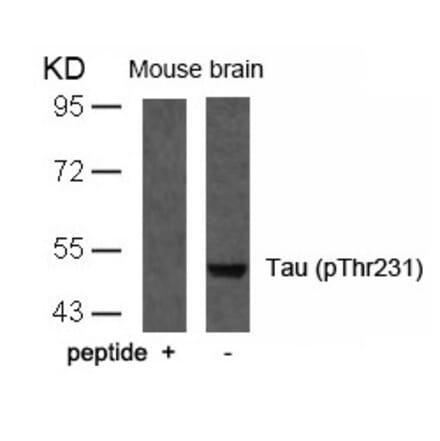 Western blot - Tau (Phospho-Thr231) Antibody from Signalway Antibody (11110) - Antibodies.com