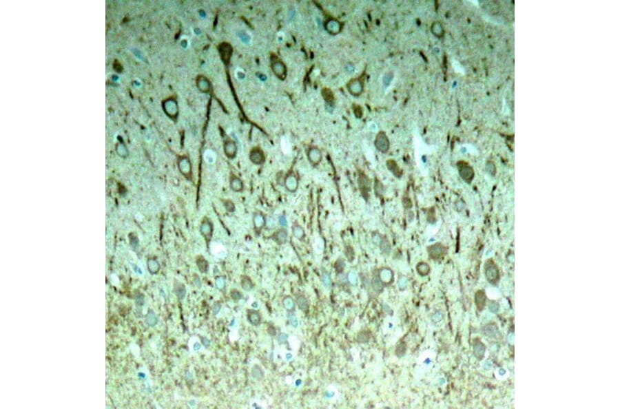 Immunohistochemistry - Tau (Phospho-Thr231) Antibody from Signalway Antibody (11110) - Antibodies.com
