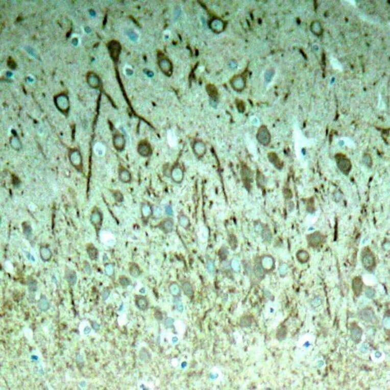 Immunohistochemistry - Tau (Phospho-Thr231) Antibody from Signalway Antibody (11110) - Antibodies.com