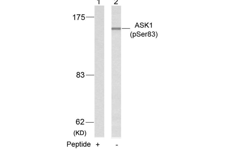 Western blot - ASK1 (Phospho-Ser83) Antibody from Signalway Antibody (11178) - Antibodies.com