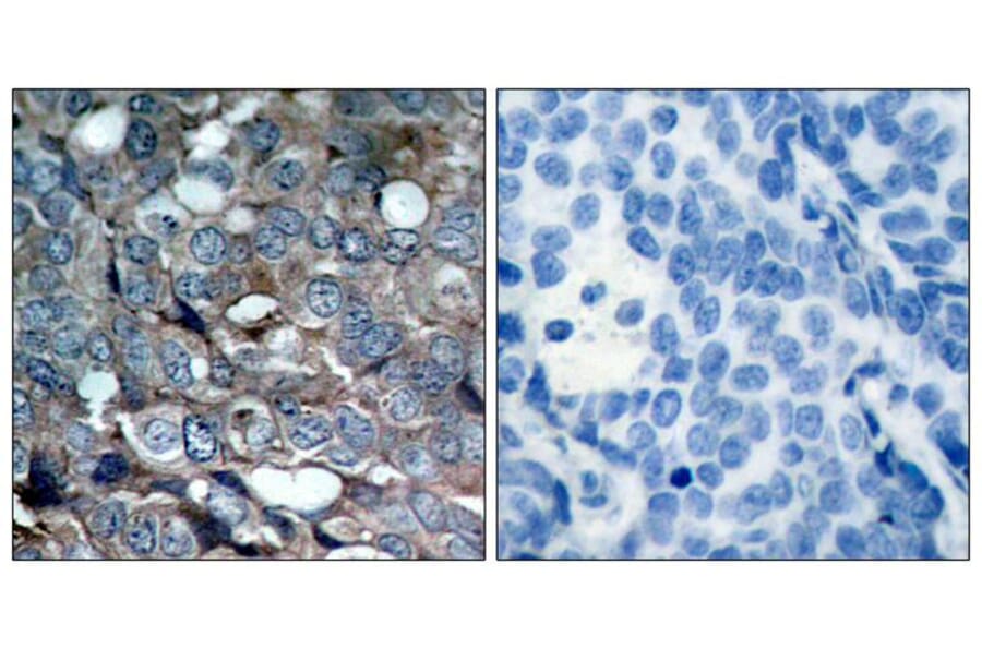 Immunohistochemistry - ASK1 (Phospho-Ser83) Antibody from Signalway Antibody (11178) - Antibodies.com