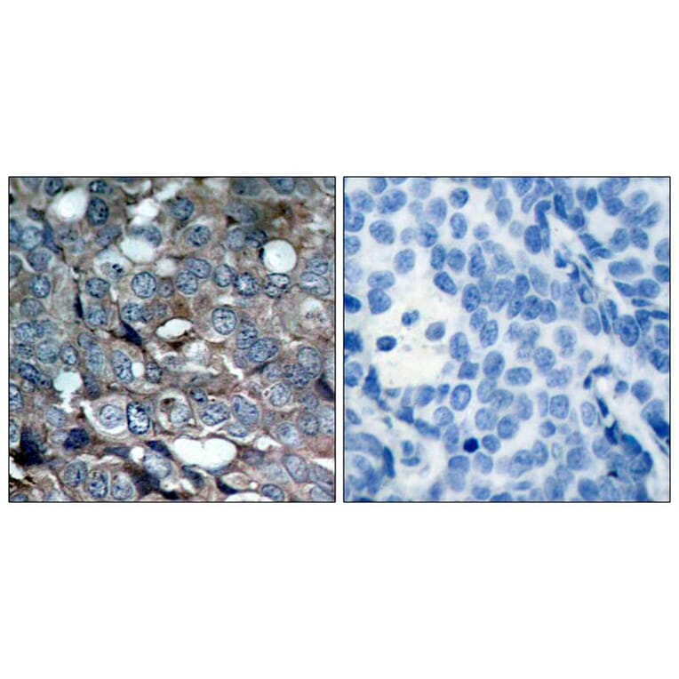 Immunohistochemistry - ASK1 (Phospho-Ser83) Antibody from Signalway Antibody (11178) - Antibodies.com