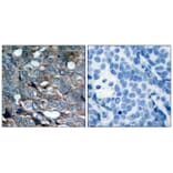 Immunohistochemistry - ASK1 (Phospho-Ser83) Antibody from Signalway Antibody (11178) - Antibodies.com