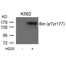 Western blot - Bcr (Phospho-Tyr177) Antibody from Signalway Antibody (11199) - Antibodies.com