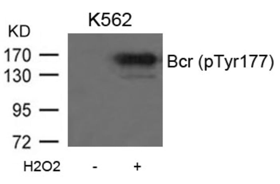 Western blot - Bcr (Phospho-Tyr177) Antibody from Signalway Antibody (11199) - Antibodies.com