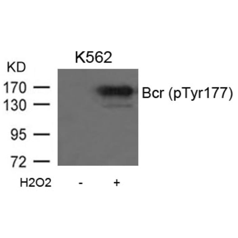 Western blot - Bcr (Phospho-Tyr177) Antibody from Signalway Antibody (11199) - Antibodies.com