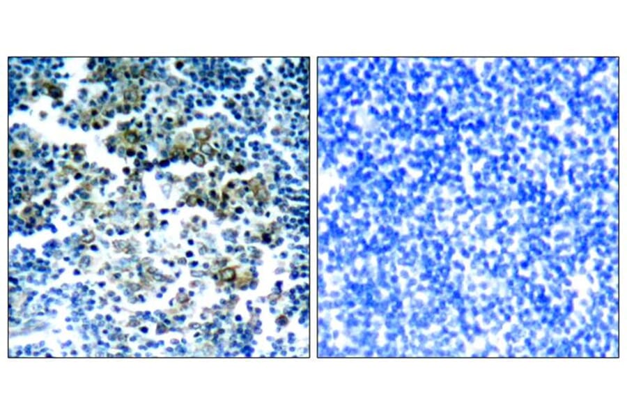 Immunohistochemistry - Bcr (Phospho-Tyr177) Antibody from Signalway Antibody (11199) - Antibodies.com