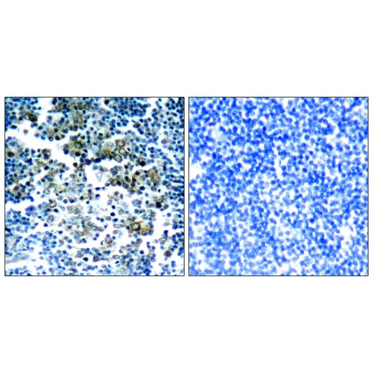 Immunohistochemistry - Bcr (Phospho-Tyr177) Antibody from Signalway Antibody (11199) - Antibodies.com