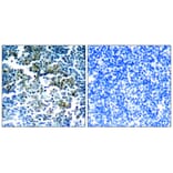 Immunohistochemistry - Bcr (Phospho-Tyr177) Antibody from Signalway Antibody (11199) - Antibodies.com