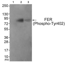 Western blot - FER (Phospho-Tyr402) Antibody from Signalway Antibody (11730) - Antibodies.com