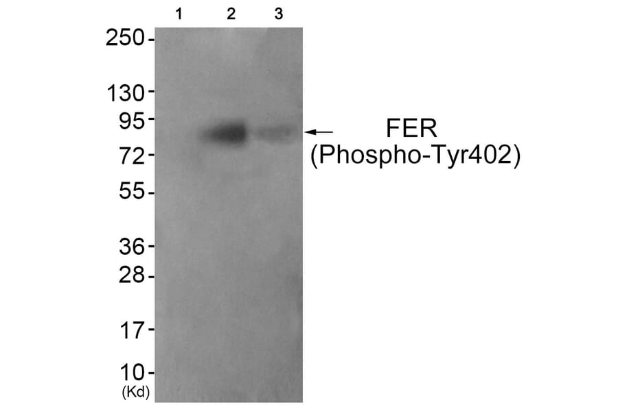 Western blot - FER (Phospho-Tyr402) Antibody from Signalway Antibody (11730) - Antibodies.com