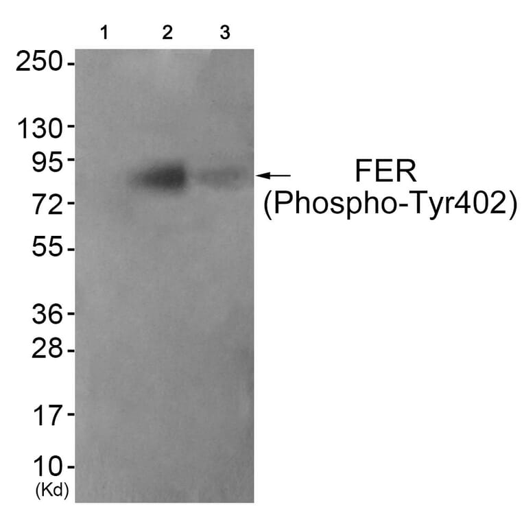 Western blot - FER (Phospho-Tyr402) Antibody from Signalway Antibody (11730) - Antibodies.com