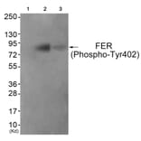 Western blot - FER (Phospho-Tyr402) Antibody from Signalway Antibody (11730) - Antibodies.com