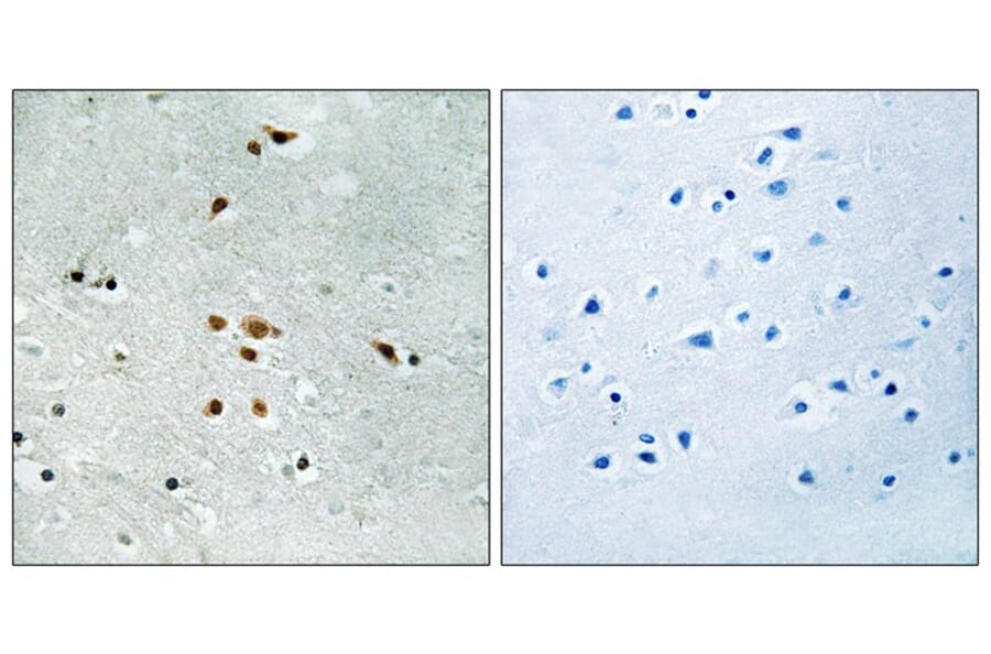 Immunohistochemistry - FER (Phospho-Tyr402) Antibody from Signalway Antibody (11730) - Antibodies.com