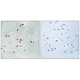 Immunohistochemistry - FER (Phospho-Tyr402) Antibody from Signalway Antibody (11730) - Antibodies.com