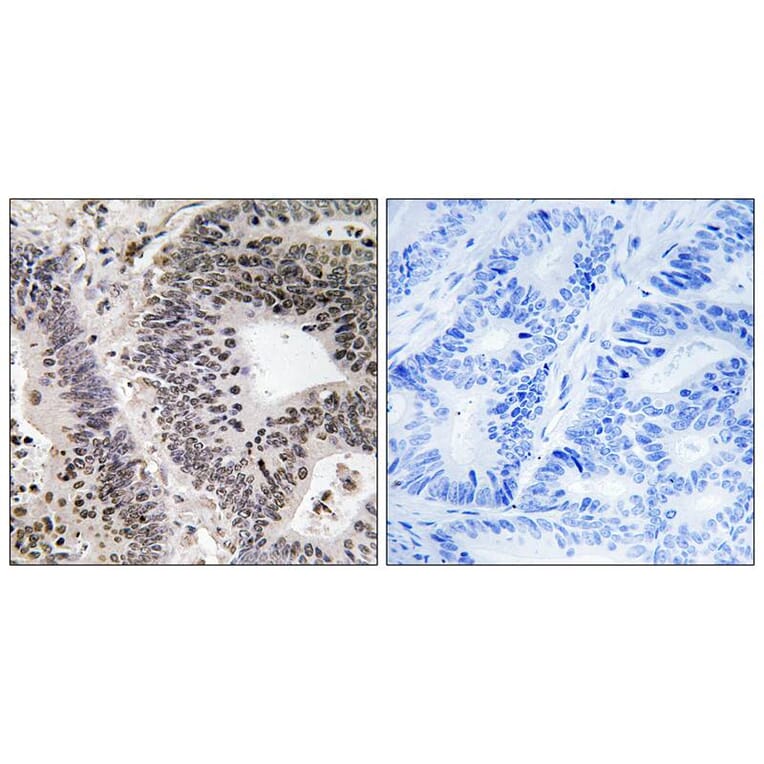 Immunohistochemistry - WWOX (Phospho-Tyr33) Antibody from Signalway Antibody (11779) - Antibodies.com