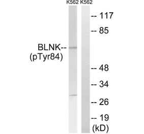Western blot - BLNK (Phospho-Tyr84) Antibody from Signalway Antibody (12132) - Antibodies.com