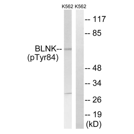 Western blot - BLNK (Phospho-Tyr84) Antibody from Signalway Antibody (12132) - Antibodies.com