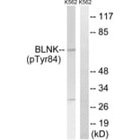 Western blot - BLNK (Phospho-Tyr84) Antibody from Signalway Antibody (12132) - Antibodies.com