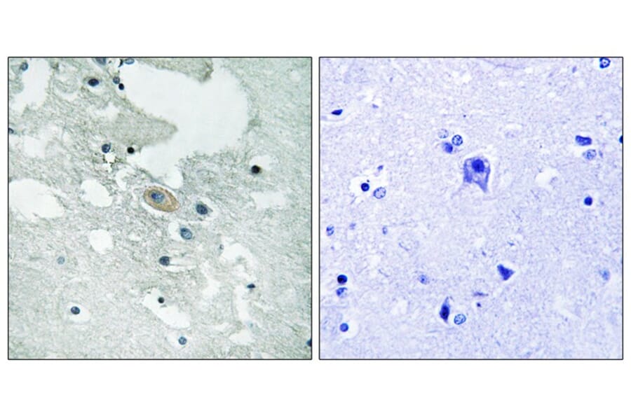 Immunohistochemistry - BLNK (Phospho-Tyr84) Antibody from Signalway Antibody (12132) - Antibodies.com
