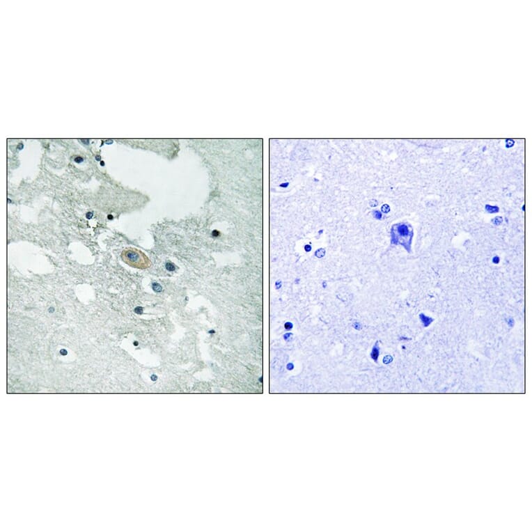 Immunohistochemistry - BLNK (Phospho-Tyr84) Antibody from Signalway Antibody (12132) - Antibodies.com