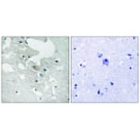 Immunohistochemistry - BLNK (Phospho-Tyr84) Antibody from Signalway Antibody (12132) - Antibodies.com