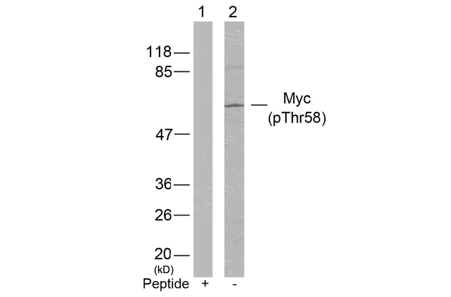 Western blot - Myc (Phospho-Thr58) Antibody from Signalway Antibody (11034) - Antibodies.com