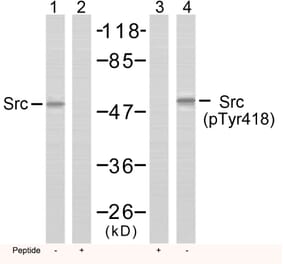 Western blot - Src (Phospho-Tyr418) Antibody from Signalway Antibody (11091) - Antibodies.com