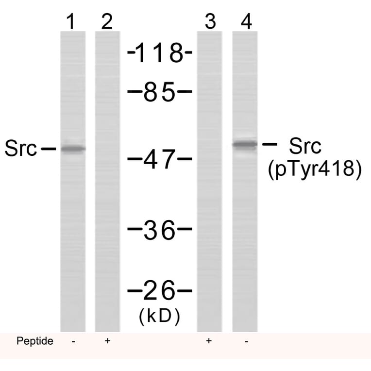 Western blot - Src (Phospho-Tyr418) Antibody from Signalway Antibody (11091) - Antibodies.com