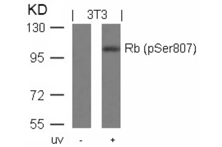 Western blot - Rb (Phospho-Ser807) Antibody from Signalway Antibody (11131) - Antibodies.com
