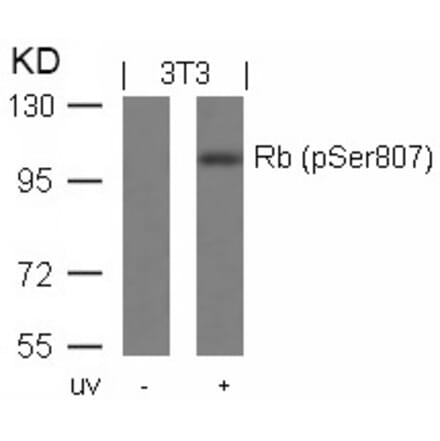 Western blot - Rb (Phospho-Ser807) Antibody from Signalway Antibody (11131) - Antibodies.com
