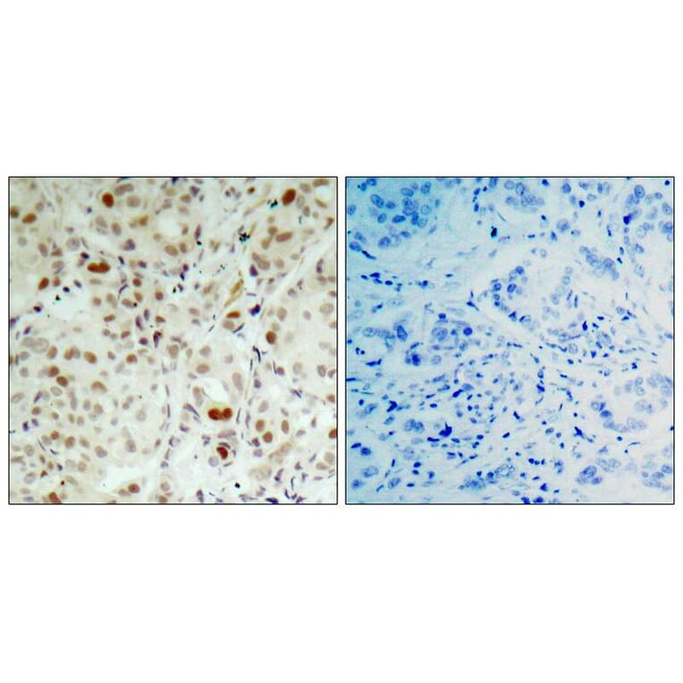 Immunohistochemistry - Rb (Phospho-Ser807) Antibody from Signalway Antibody (11131) - Antibodies.com