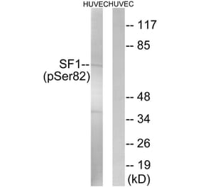 Western blot - SF1 (Phospho-Ser82) Antibody from Signalway Antibody (11669) - Antibodies.com