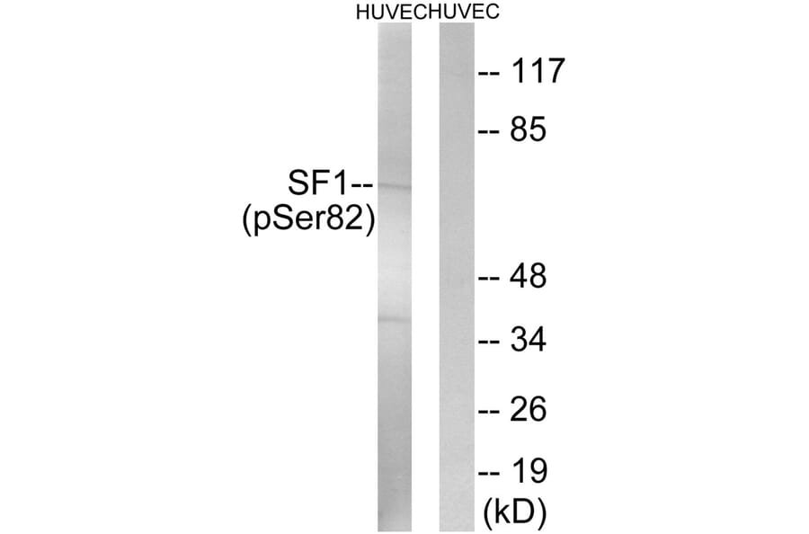 Western blot - SF1 (Phospho-Ser82) Antibody from Signalway Antibody (11669) - Antibodies.com