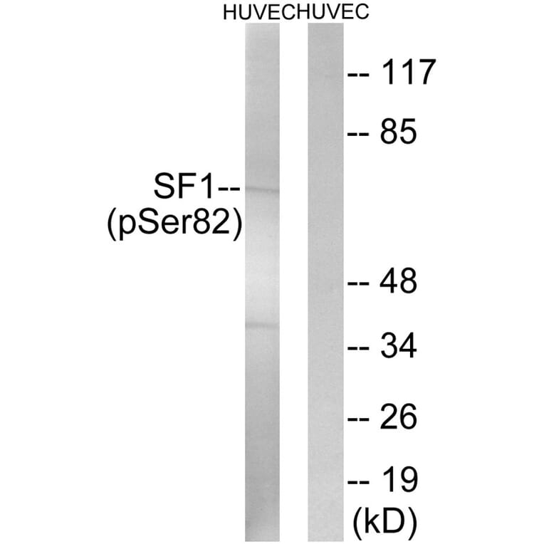 Western blot - SF1 (Phospho-Ser82) Antibody from Signalway Antibody (11669) - Antibodies.com