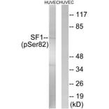 Western blot - SF1 (Phospho-Ser82) Antibody from Signalway Antibody (11669) - Antibodies.com