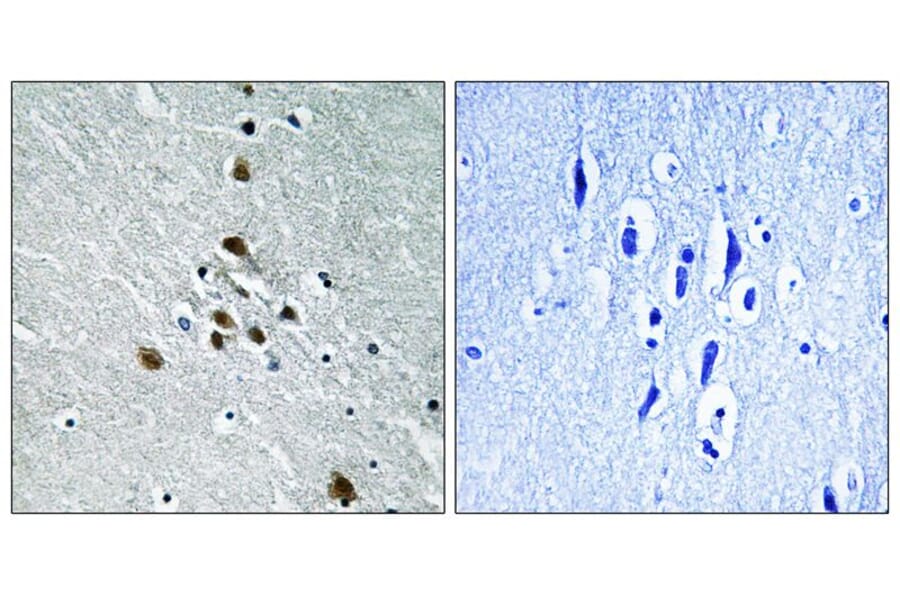 Immunohistochemistry - SF1 (Phospho-Ser82) Antibody from Signalway Antibody (11669) - Antibodies.com
