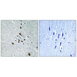 Immunohistochemistry - SF1 (Phospho-Ser82) Antibody from Signalway Antibody (11669) - Antibodies.com