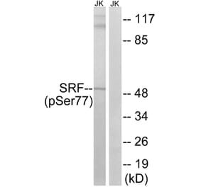 Western blot - SRF (Phospho-Ser77) Antibody from Signalway Antibody (12151) - Antibodies.com
