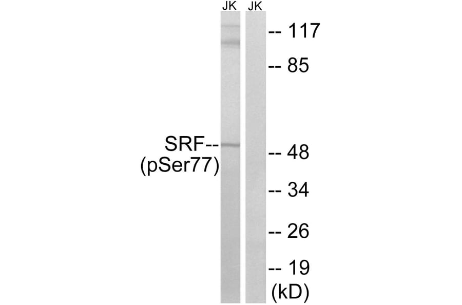 Western blot - SRF (Phospho-Ser77) Antibody from Signalway Antibody (12151) - Antibodies.com