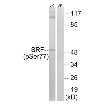 Western blot - SRF (Phospho-Ser77) Antibody from Signalway Antibody (12151) - Antibodies.com