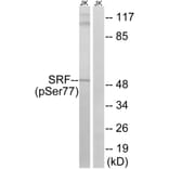Western blot - SRF (Phospho-Ser77) Antibody from Signalway Antibody (12151) - Antibodies.com