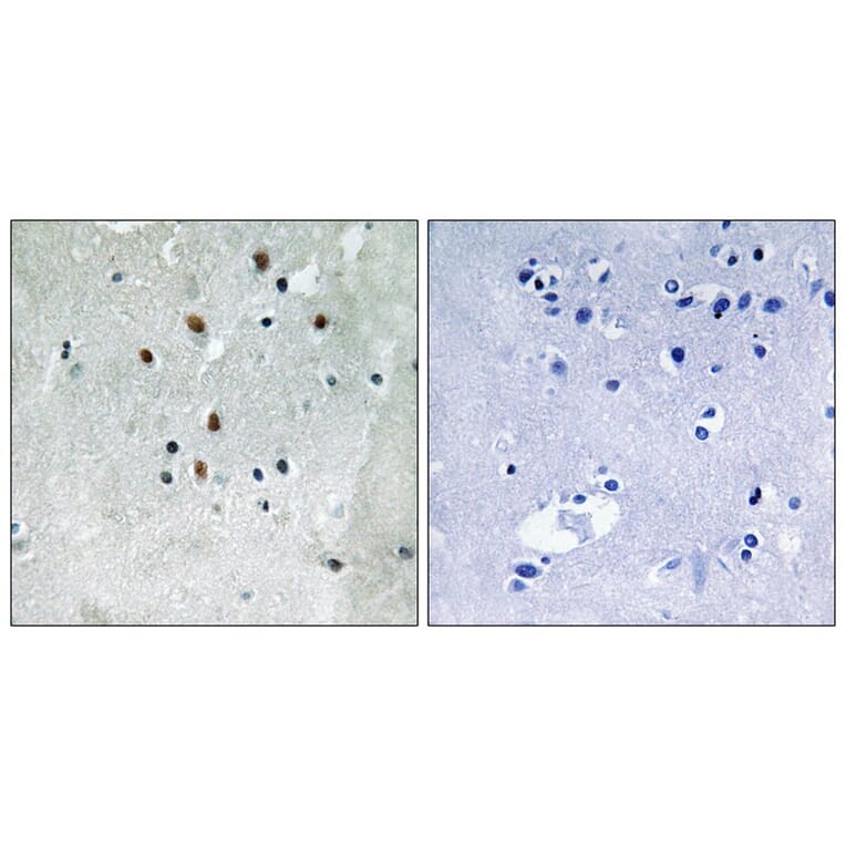 Immunohistochemistry - SRF (Phospho-Ser77) Antibody from Signalway Antibody (12151) - Antibodies.com