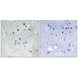 Immunohistochemistry - SRF (Phospho-Ser77) Antibody from Signalway Antibody (12151) - Antibodies.com