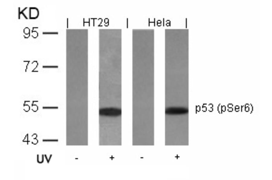 Western blot - p53 (Phospho-Ser6) Antibody from Signalway Antibody (11092) - Antibodies.com