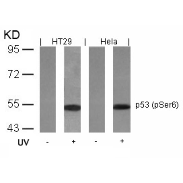 Western blot - p53 (Phospho-Ser6) Antibody from Signalway Antibody (11092) - Antibodies.com