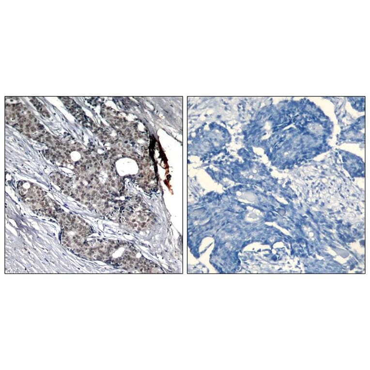 Immunohistochemistry - p53 (Phospho-Ser6) Antibody from Signalway Antibody (11092) - Antibodies.com
