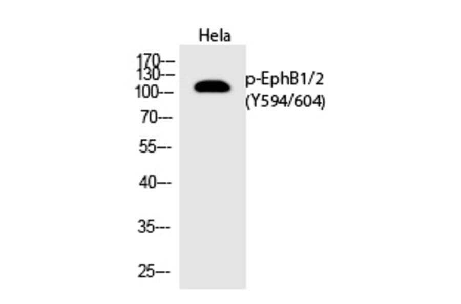 Western blot - EphB1/2 (Phospho-Tyr594/604) Polyclonal Antibody from Signalway Antibody (12273) - Antibodies.com